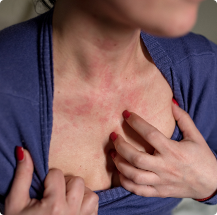 Consultation detail, discussing an inflammatory skin condition